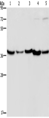 Anti-Human/Mouse DNAJB4 Antibody - ABMIUM