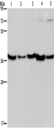 Anti-Human/Mouse DNAJB4 Antibody - ABMIUM