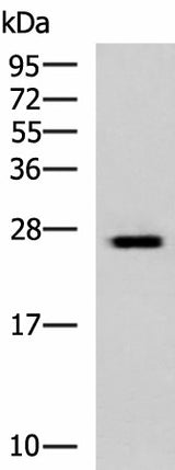 Western blot analysis of Hela cell lysate using GINS3 Polyclonal Antibody at dilution of 1:800