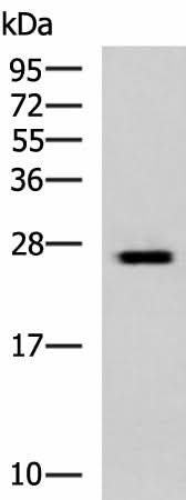 Western blot analysis of Hela cell lysate using GINS3 Polyclonal Antibody at dilution of 1:800