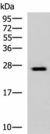 Western blot analysis of Hela cell lysate using GINS3 Polyclonal Antibody at dilution of 1:800