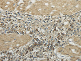 Anti-Human/Mouse TRIB2 Antibody - ABMIUM