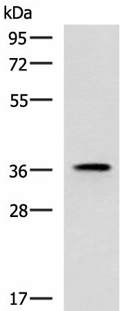 Western blot analysis of Mouse adrenal gland tissue lysate using USP50 Polyclonal Antibody at dilution of 1:400
