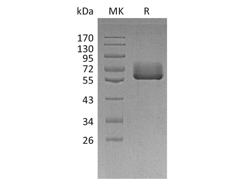 Recombinant Human BTN2A2 Protein (Fc Tag) - ABMIUM