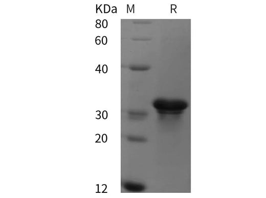 SDS-PAGE analysis of Human BAG3 proteins, 2 μg/lane of Recombinant Human BAG3 proteins was resolved with SDS-PAGE under reducing conditions, showing bands at 35 kDa.