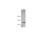 Anti-Human/Rat PIK3CA Antibody - ABMIUM