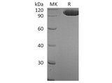 Recombinant Human EphA2 Protein (Fc Tag) - ABMIUM