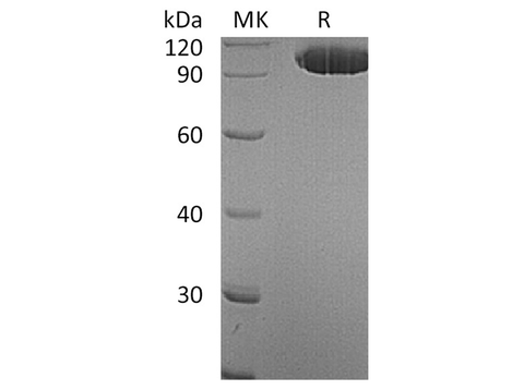 Recombinant Human EphA2 Protein (Fc Tag) - ABMIUM