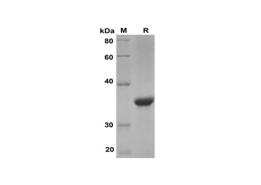 SDS-PAGE analysis of Human IL-32α proteins, 2 μg/lane of Recombinant Human IL-32α proteins was resolved with SDS-PAGE under reducing conditions, showing bands at 35 kDa.