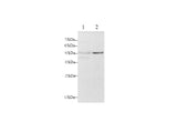 Anti-Human FAS/CD95 Antibody - ABMIUM