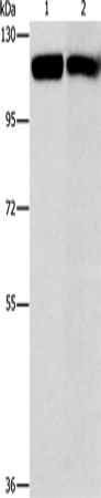 Anti-Human/Mouse CBL Antibody - ABMIUM
