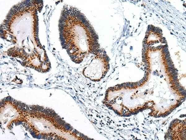Anti-Human/Mouse/Rat ARFGAP2 Antibody