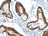 Anti-Human/Mouse/Rat ARFGAP2 Antibody - ABMIUM