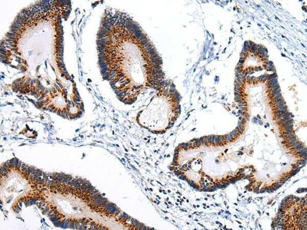 Anti-Human/Mouse/Rat ARFGAP2 Antibody - ABMIUM