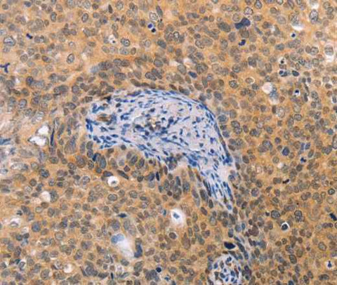 Anti-Human pVHL Antibody