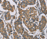 Anti-Human HDAC6 Antibody - ABMIUM