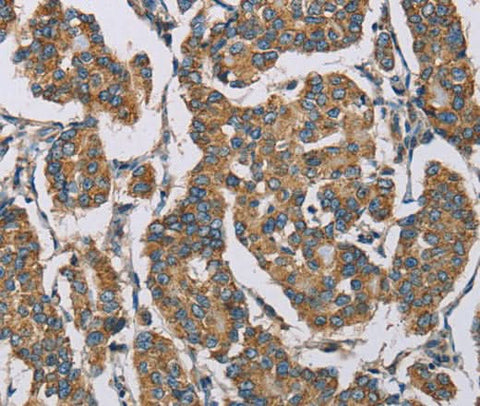 Anti-Human HDAC6 Antibody - ABMIUM