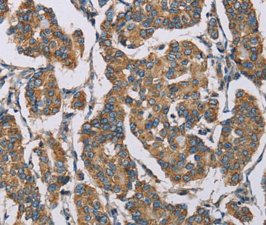 Anti-Human HDAC6 Antibody - ABMIUM