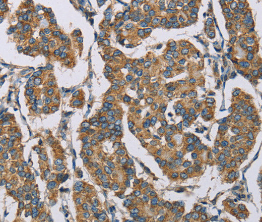 Anti-Human HDAC6 Antibody - ABMIUM
