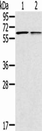 Anti-Human/Mouse PTGER2 Antibody
