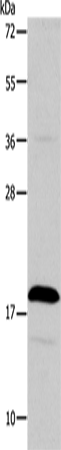 Anti-Human TSLP Antibody - ABMIUM