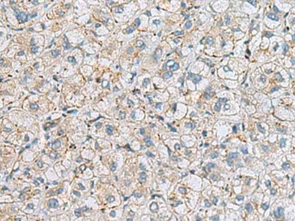Anti-Human/Mouse MTHFD2 Antibody