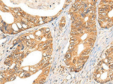 Anti-Human NOL8 Antibody - ABMIUM