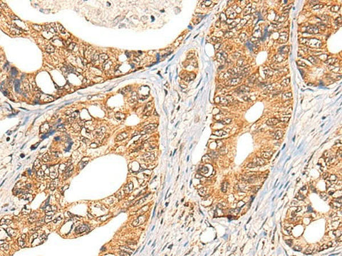 Anti-Human NOL8 Antibody - ABMIUM