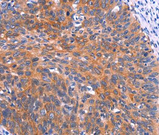 Anti-Human PTPN13 Antibody