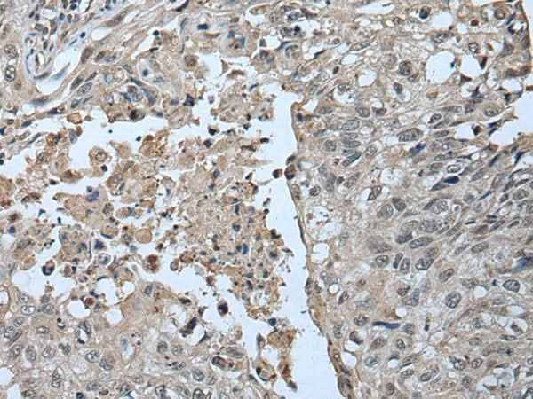 Anti-Human/Mouse UBR2 Antibody