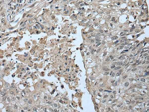 Anti-Human/Mouse UBR2 Antibody