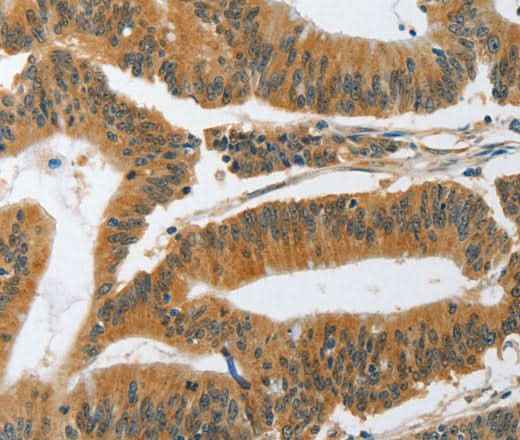 Anti-Human/Mouse/Rat PIK3R3 Antibody