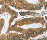 Anti-Human/Mouse/Rat PIK3R3 Antibody - ABMIUM