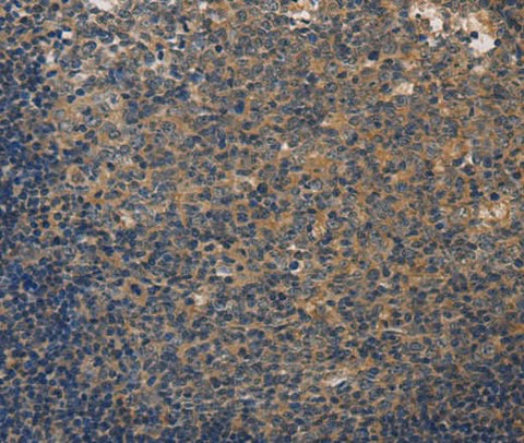 Anti-Human/Mouse/Rat DUSP26 Antibody - ABMIUM