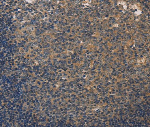 Anti-Human/Mouse/Rat DUSP26 Antibody - ABMIUM