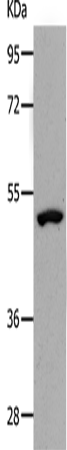 Anti-Human/Mouse/Rat NDRG1 Antibody - ABMIUM