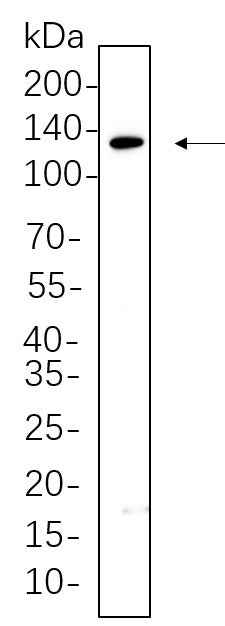 Anti-Human/Mouse/Rat JAK1 Antibody [B581] - ABMIUM