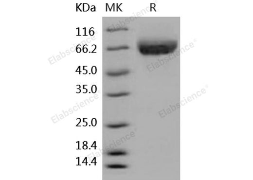 Recombinant Human ALCAM/CD166 Protein (His Tag) - ABMIUM
