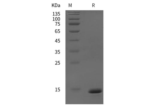 SDS-PAGE analysis of mouse IGF-2/IGF-II proteins, 2 μg/lane of Recombinant mouse IGF-2/IGF-II proteins was resolved with SDS-PAGE under reducing conditions, showing bands at 14 kDa.