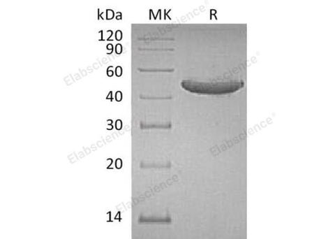 Recombinant Human GITR/TNFRSF18 Protein (Fc Tag) - ABMIUM