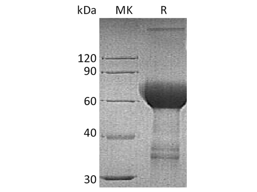Recombinant Human TROP2/TACSTD2 Protein (Fc Tag) - ABMIUM