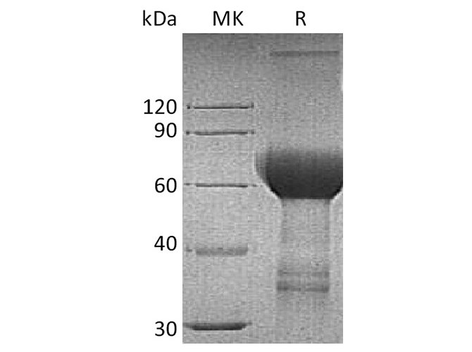 Recombinant Human TROP2/TACSTD2 Protein (Fc Tag) - ABMIUM