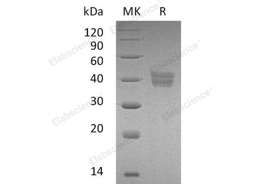 > 87 % as determined by reducing SDS-PAGE.