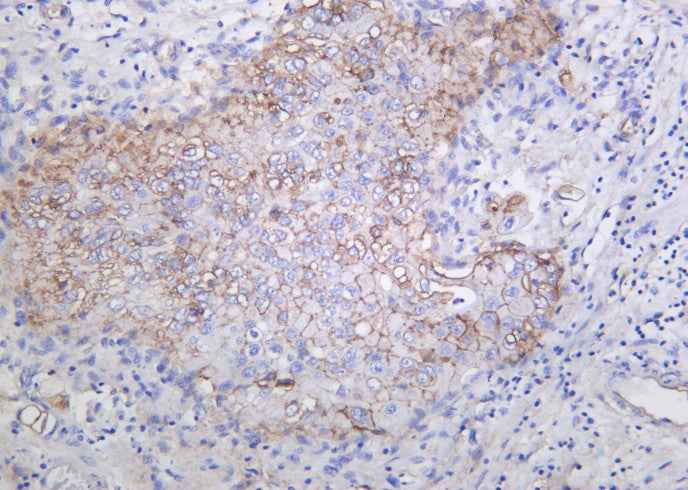 Anti-Human/Mouse/Rat Integrin αV Antibody [B1044] - ABMIUM