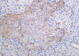 Anti-Human/Mouse/Rat Integrin αV Antibody [B1044]