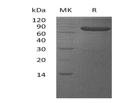 Recombinant Human VSIG4 Protein (Fc Tag) - ABMIUM