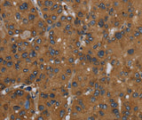 Anti-Human/Mouse/Rat ID2 Antibody - ABMIUM