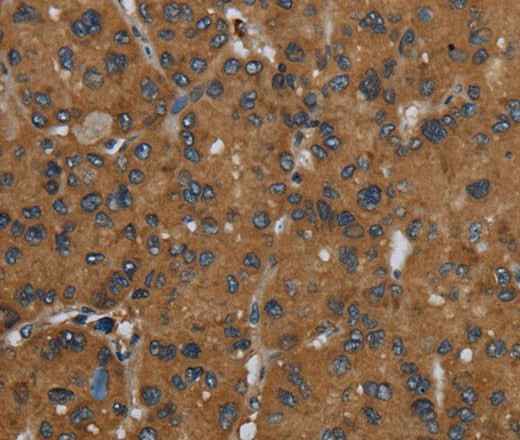 Anti-Human/Mouse/Rat ID2 Antibody