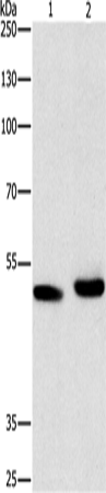 Anti-Human ATG4A Antibody - ABMIUM