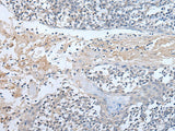 Immunohistochemistry of paraffin-embedded Human tonsil tissue using ABR Polyclonal Antibody at dilution of 1:50(×200)